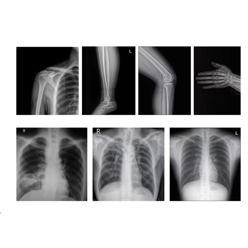 เครื่องเอกซเรย์ทางการแพทย์ ระบ - Photography X Ray บทวิจารณ์และราคา